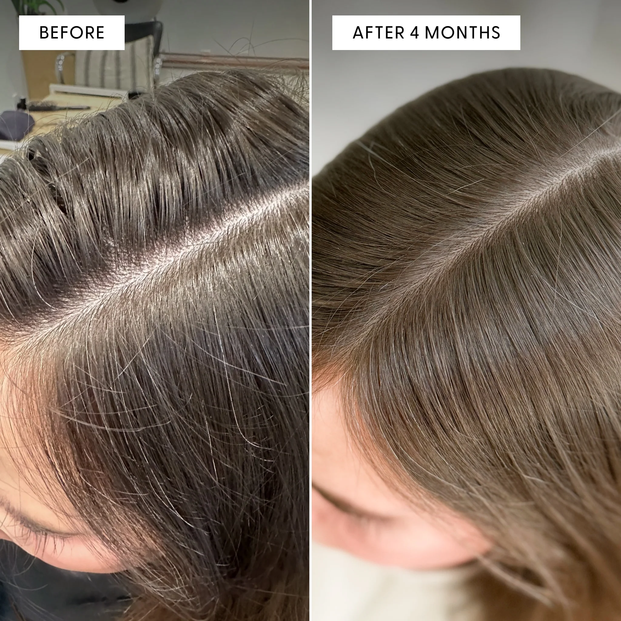 A before and after image showing a person's hair part with fewer visible gray hairs after four months.