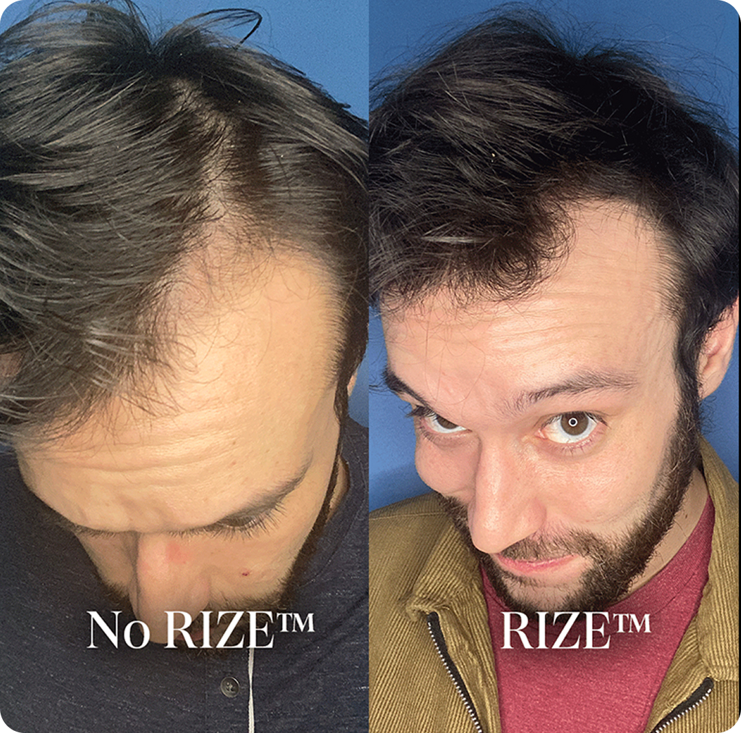 Top view of a person in a gray shirt, focusing on their head and neck.