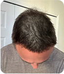 Month 5