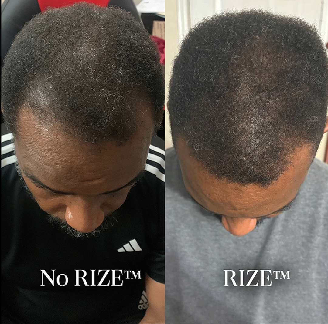 Side-by-side before and after hair treatment comparison.