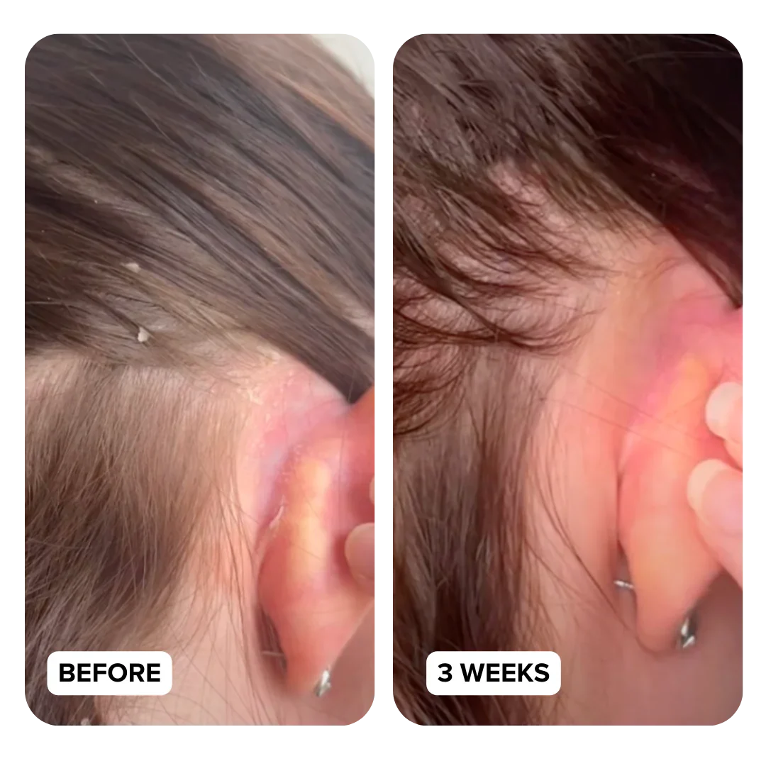 Side-by-side comparison of an ear before and after three weeks.