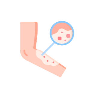 A stylized icon of an arm with a skin rash under a magnifying glass.