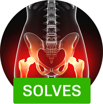 X-ray of pelvis and spine with green 'SOLVES' label.