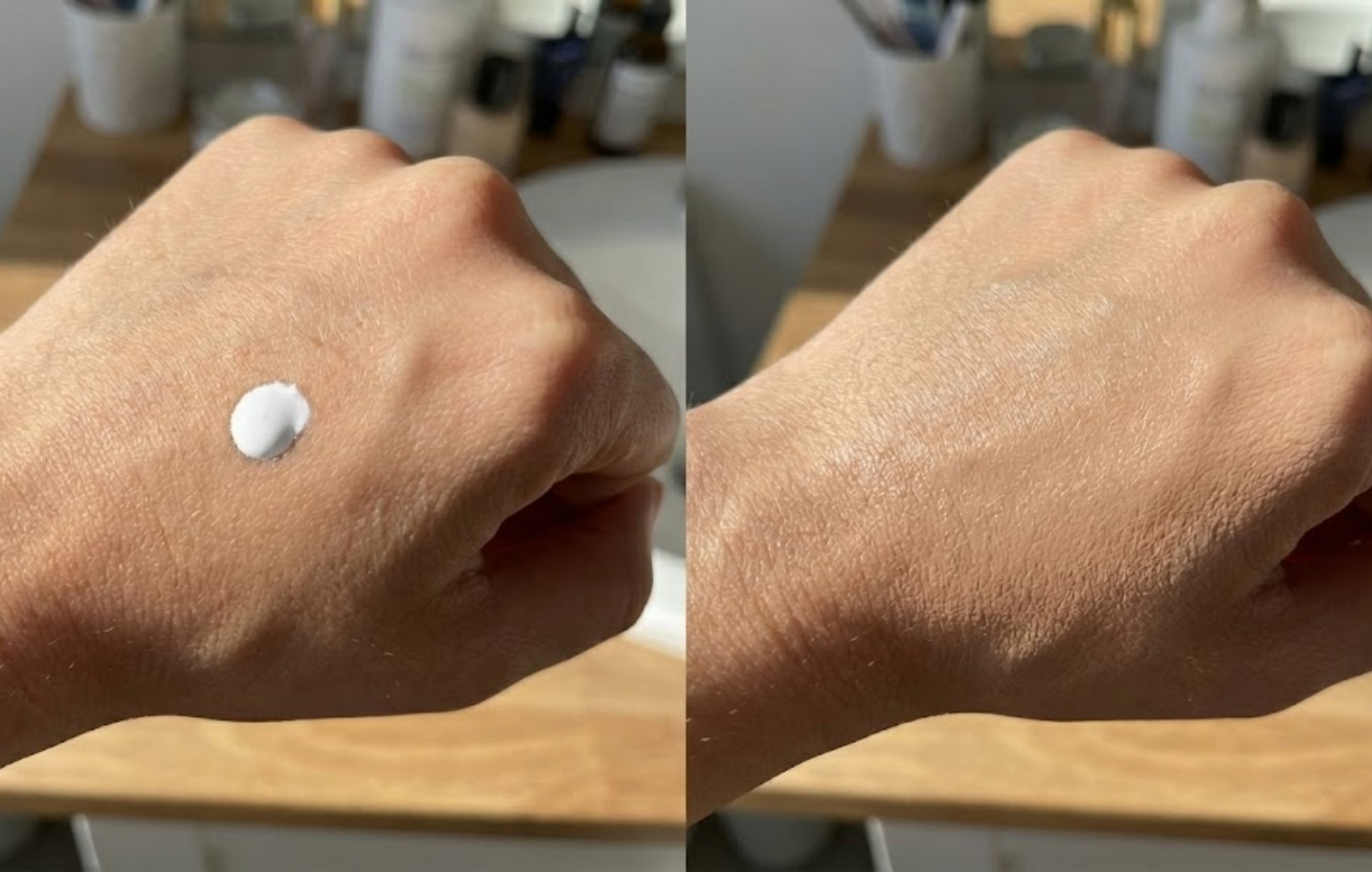 Two hands side by side; one with cream applied, and one without.