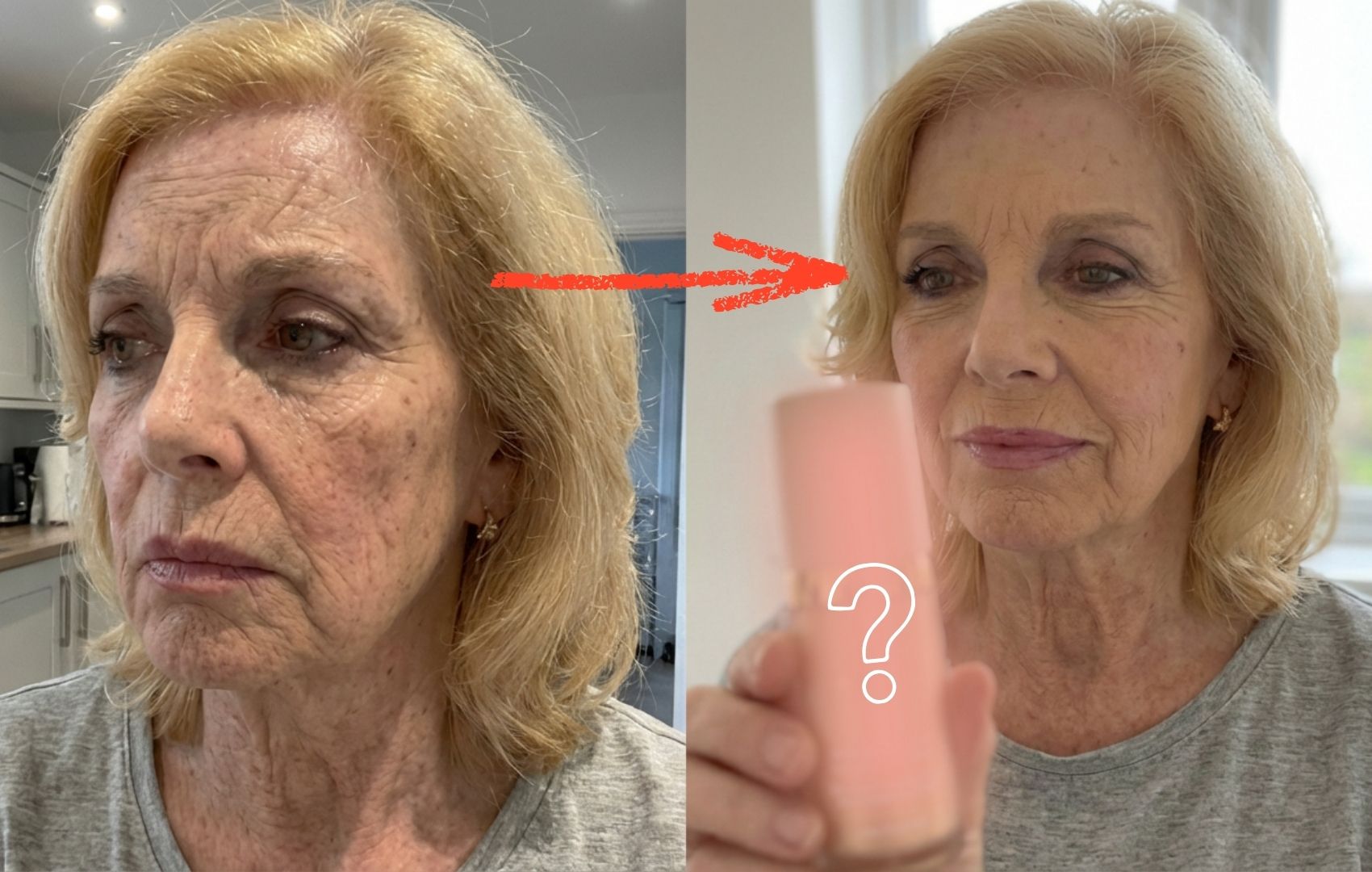 A before and after image showing a woman's face with a visible reduction in wrinkles and smoother skin.