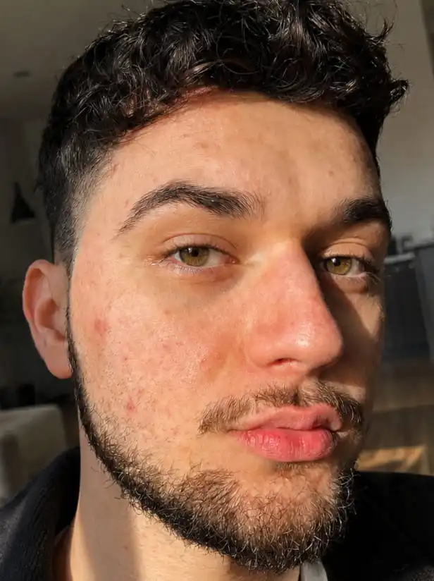 A sunlit close-up of a young man with dark curly hair, a beard, and light-colored eyes.