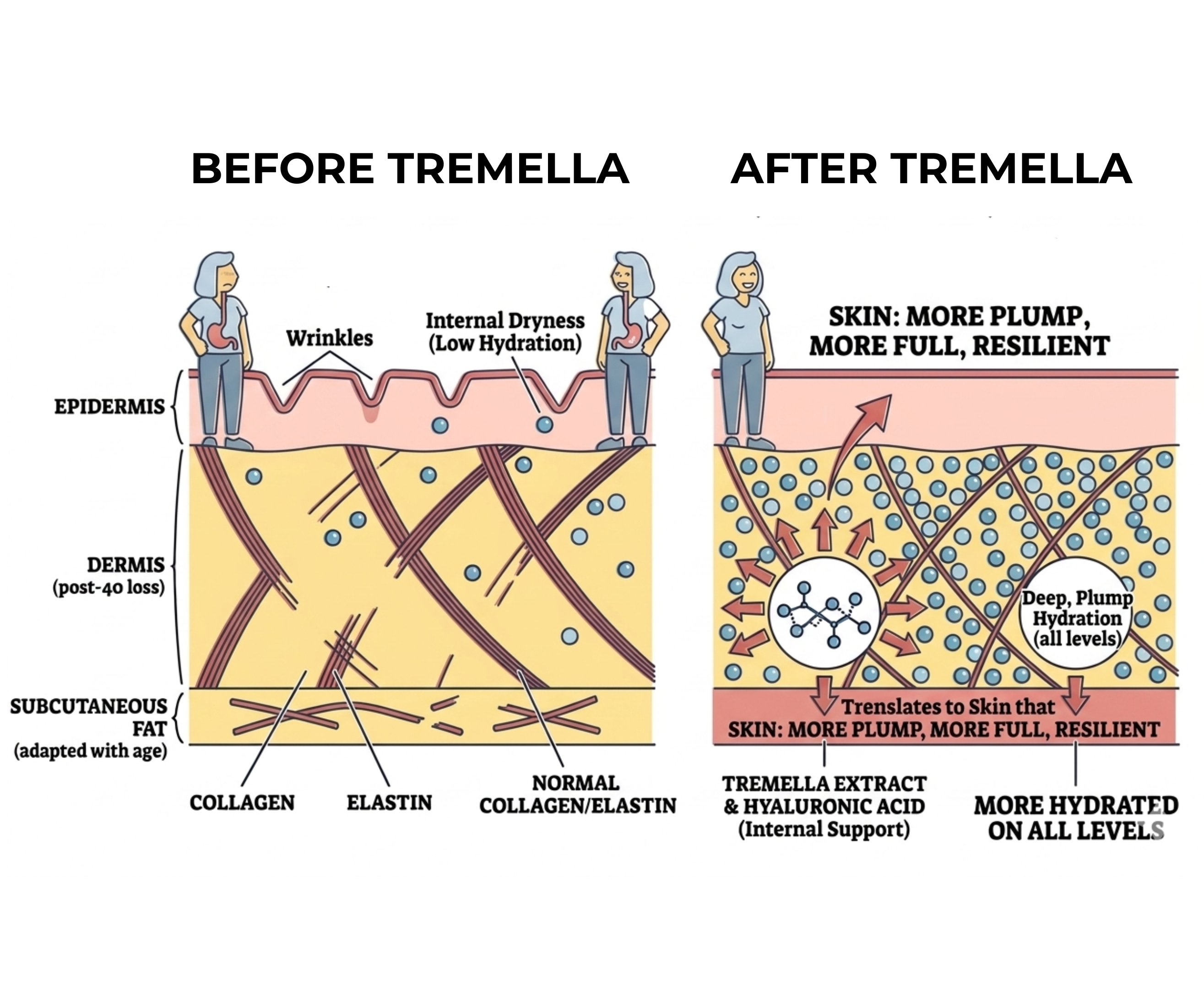 A diagram comparing skin before and after using Tremella, showing improved hydration, fullness, and resilience.