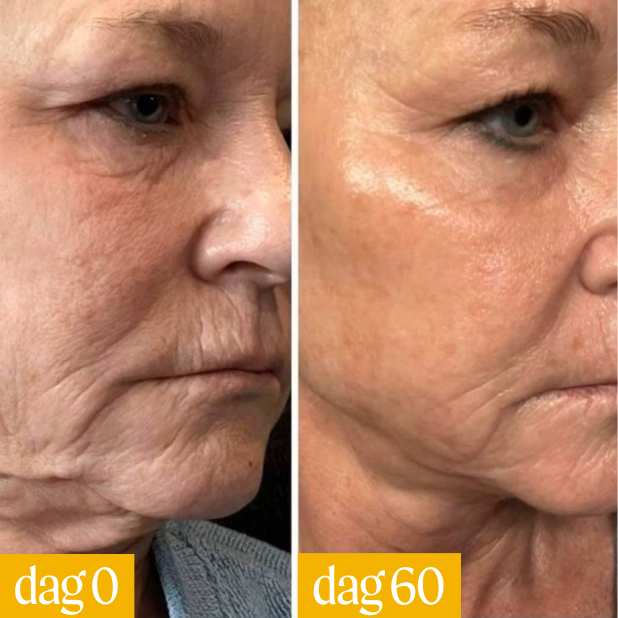 Side-by-side facial comparison labeled day 0 and day 60, showing skin changes.