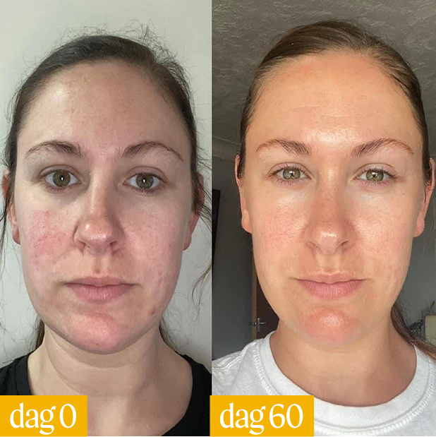 Side-by-side photos showing facial skin changes over 60 days.