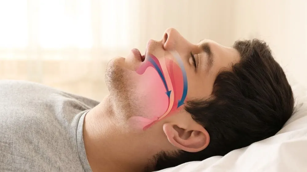 Man sleeping with anatomical illustration of air passage in throat.