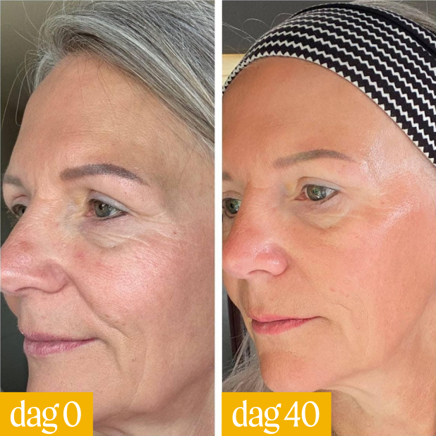 Two side-by-side images of a woman's face showing changes over 40 days.