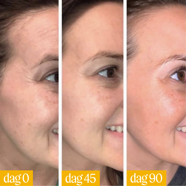 Side-by-side comparison of a woman's face over 90 days.