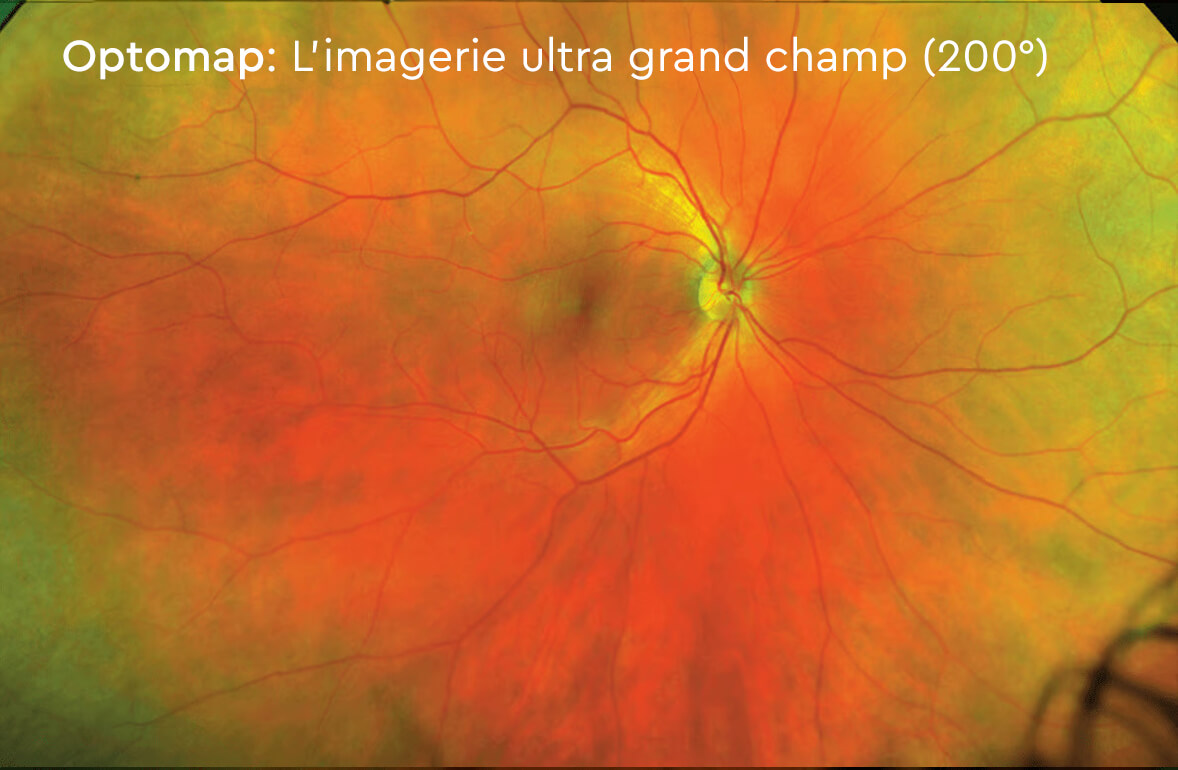 Imagerie ultra grand champ