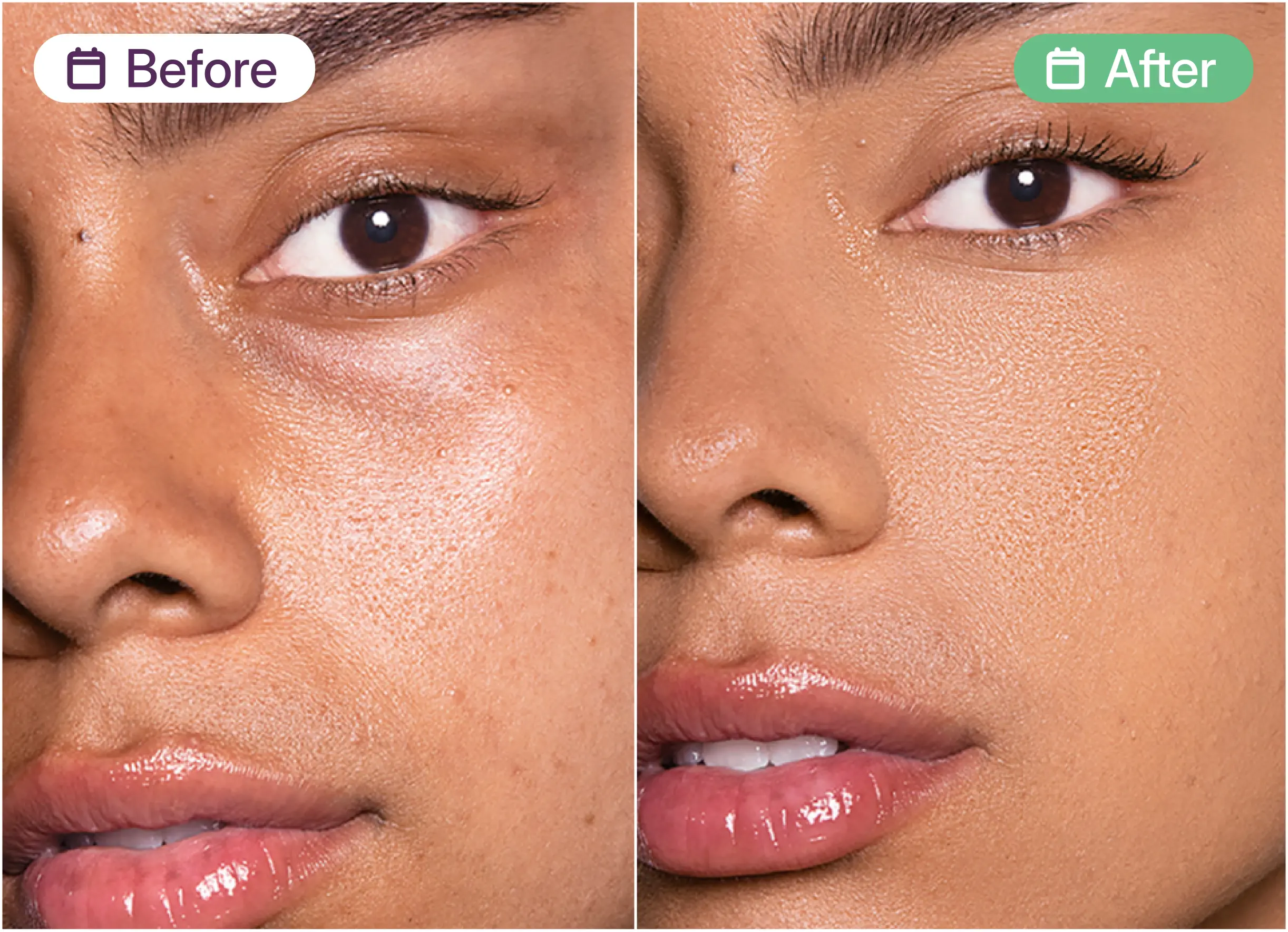 A side-by-side before and after image showing a close-up of a woman's face with smoother skin texture.