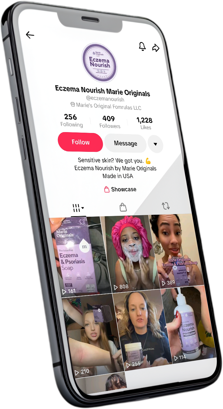 A smartphone displaying the TikTok profile page for the brand Eczema Nourish Marie Originals.