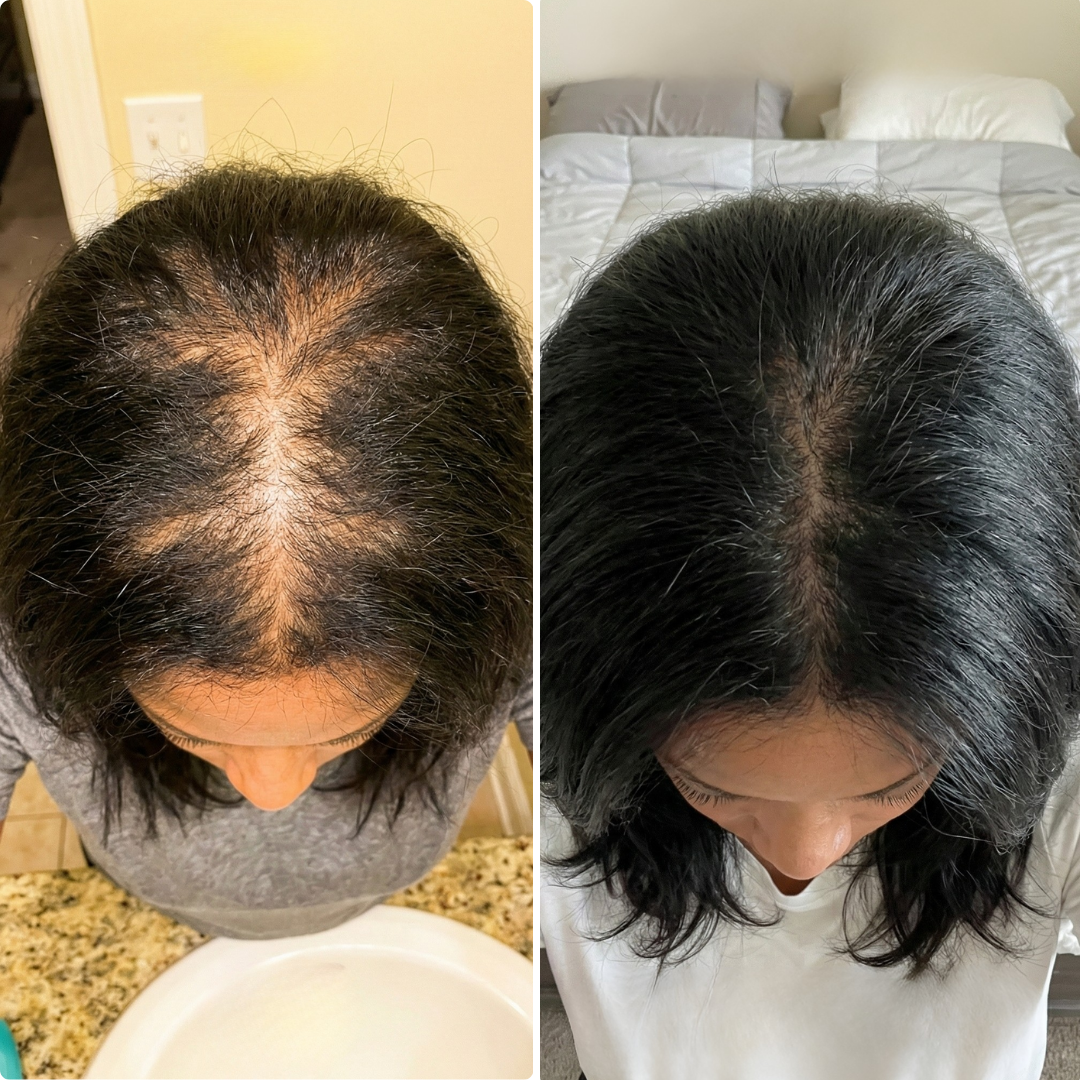 A before and after comparison showing the top of a person's head with thinning hair and then fuller hair.