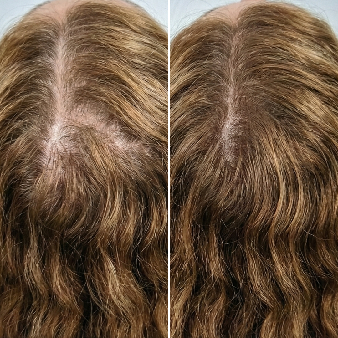 A before-and-after comparison of a woman's scalp, showing hair regrowth and increased density along the part.