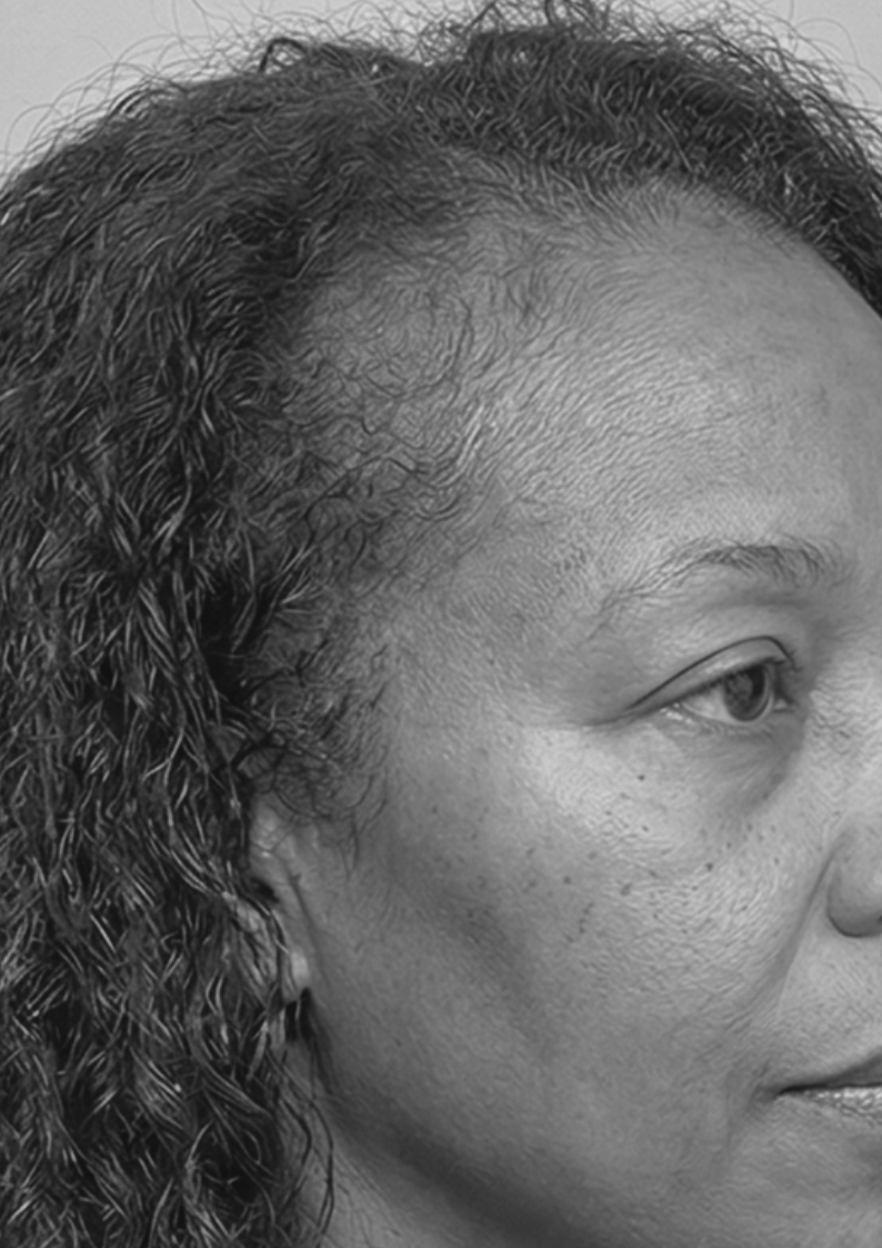 Black and white close-up of a person's profile with curly hair.