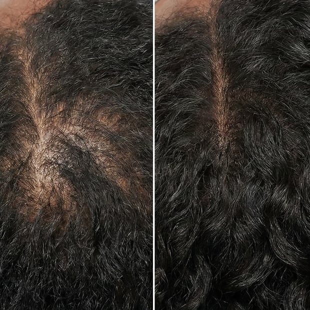 Before and after results