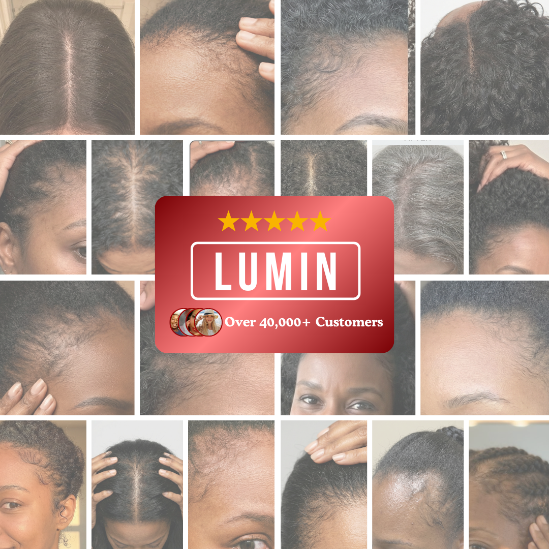 A collage of close-up photos of various people's hairlines with a LUMIN brand logo in the center.