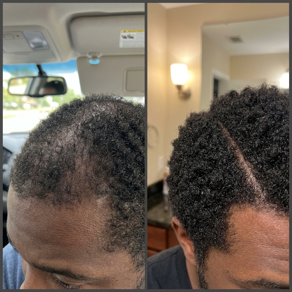 A side-by-side comparison of a person's scalp, showing thinner hair on the left and thicker hair on the right.