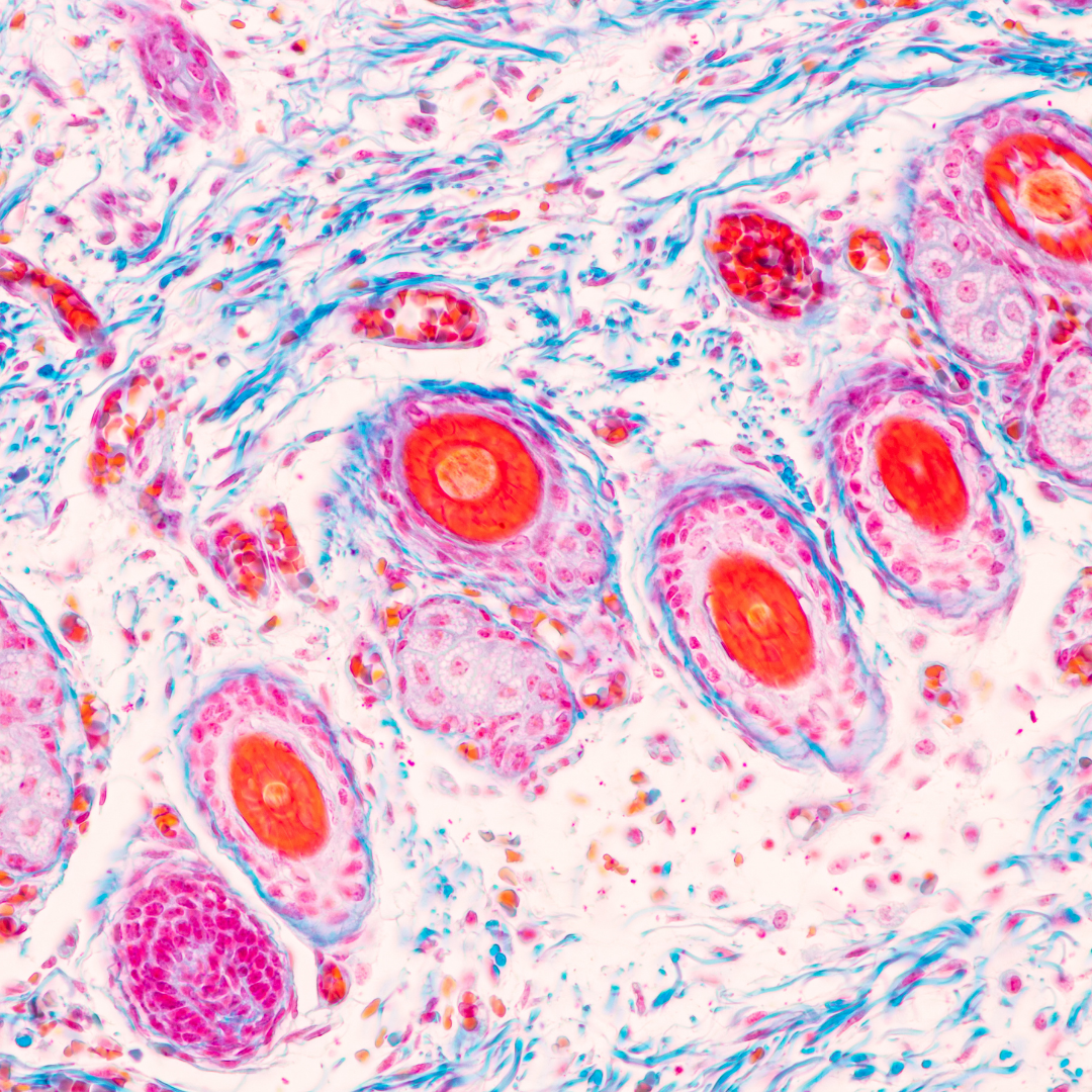 Brightly stained microscopic tissue with red, pink, and blue cellular structures.