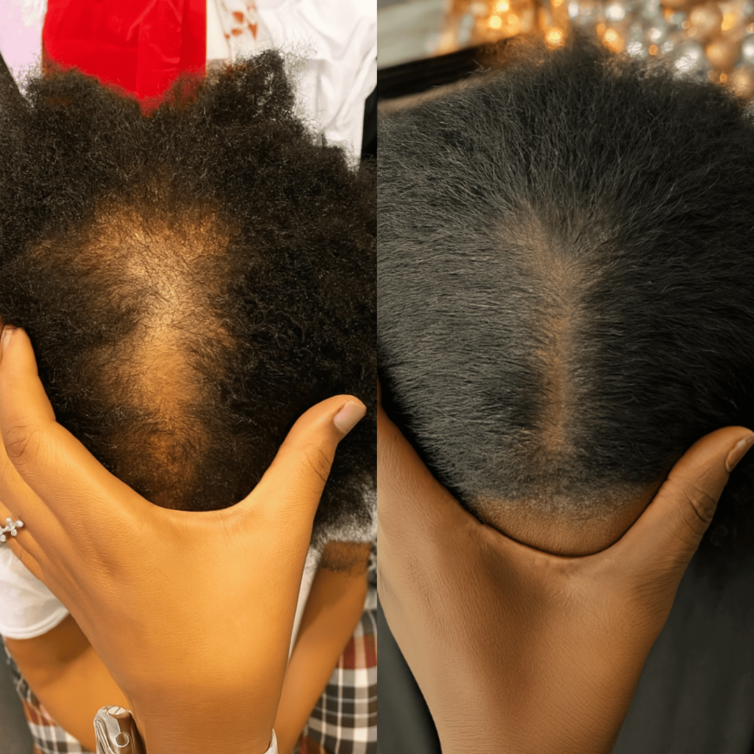 Side-by-side comparison of hair before and after treatment, showing improved hair density.