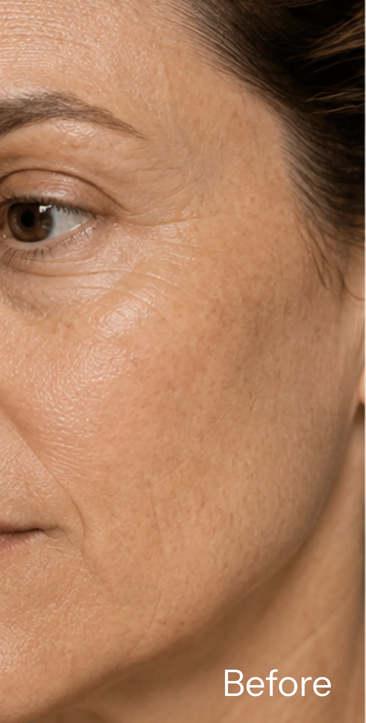 A close-up of a woman's face showing wrinkles and fine lines, with the word 'Before' in the corner.