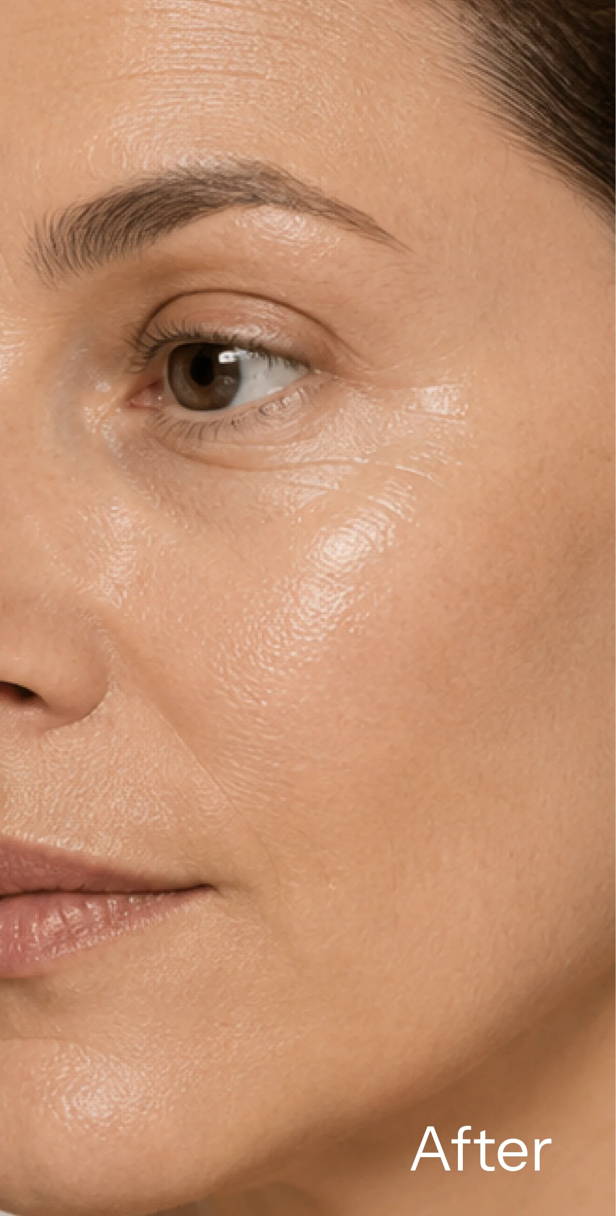 A close-up of a woman's cheek and eye area, with the word 'After' written in the corner.