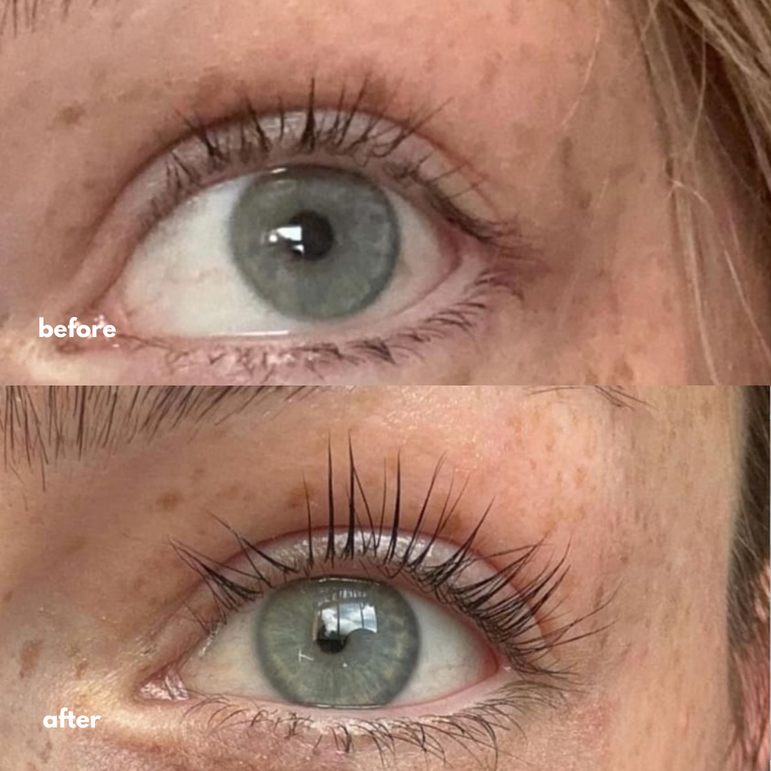Close-up comparison of an eye before and after, showing longer eyelashes in the after image.