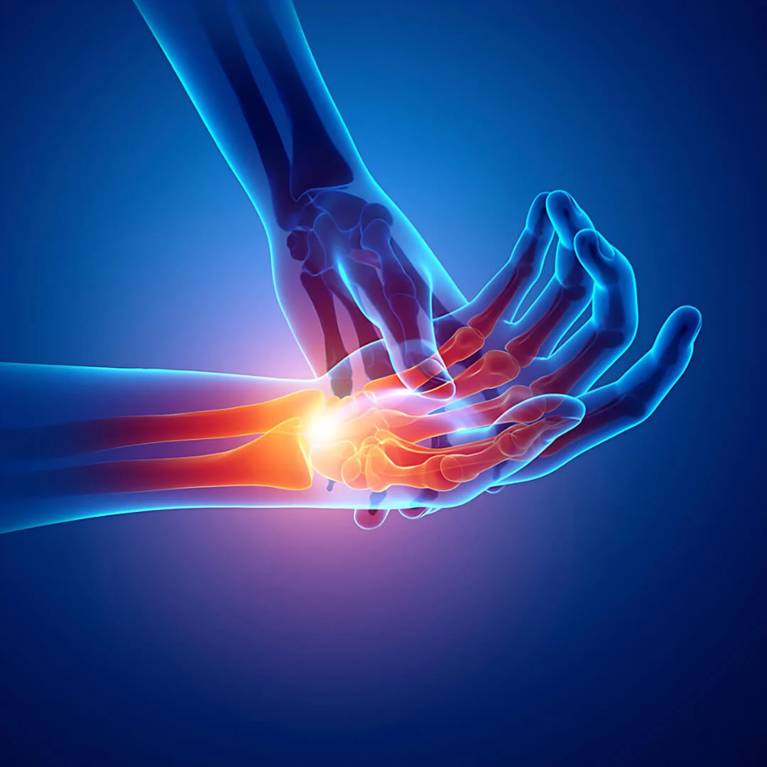 X-ray illustration of a hand highlighting pain in the wrist area with bright colors.