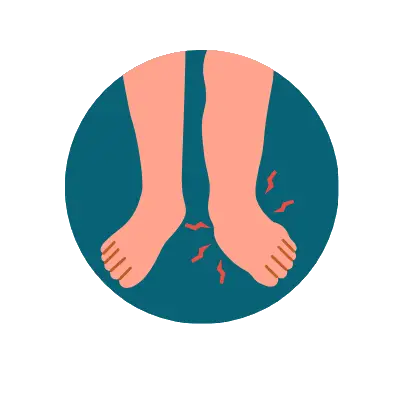 An illustration of two feet and lower legs with red squiggly lines around them indicating pain or tingling.