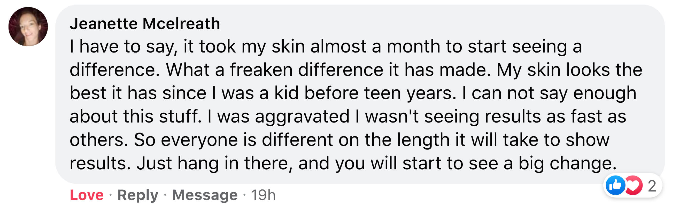 Facebook comment praising skincare results with a profile picture and reactions.