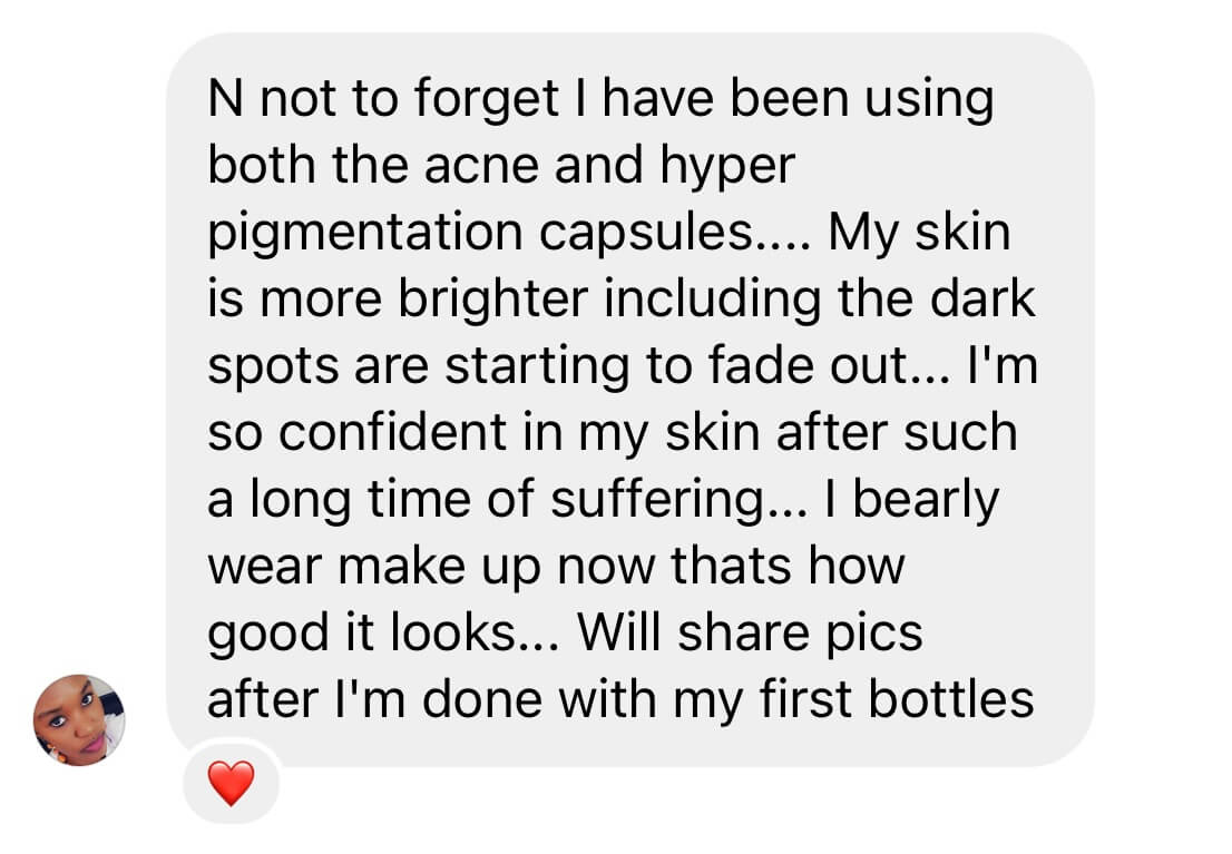 Text message about skincare improvement with a small profile picture and heart emoji.