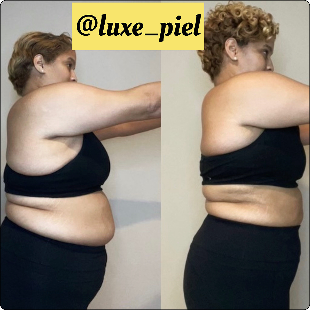 Side-by-side comparison of a person in black workout attire, showing different body profiles.
