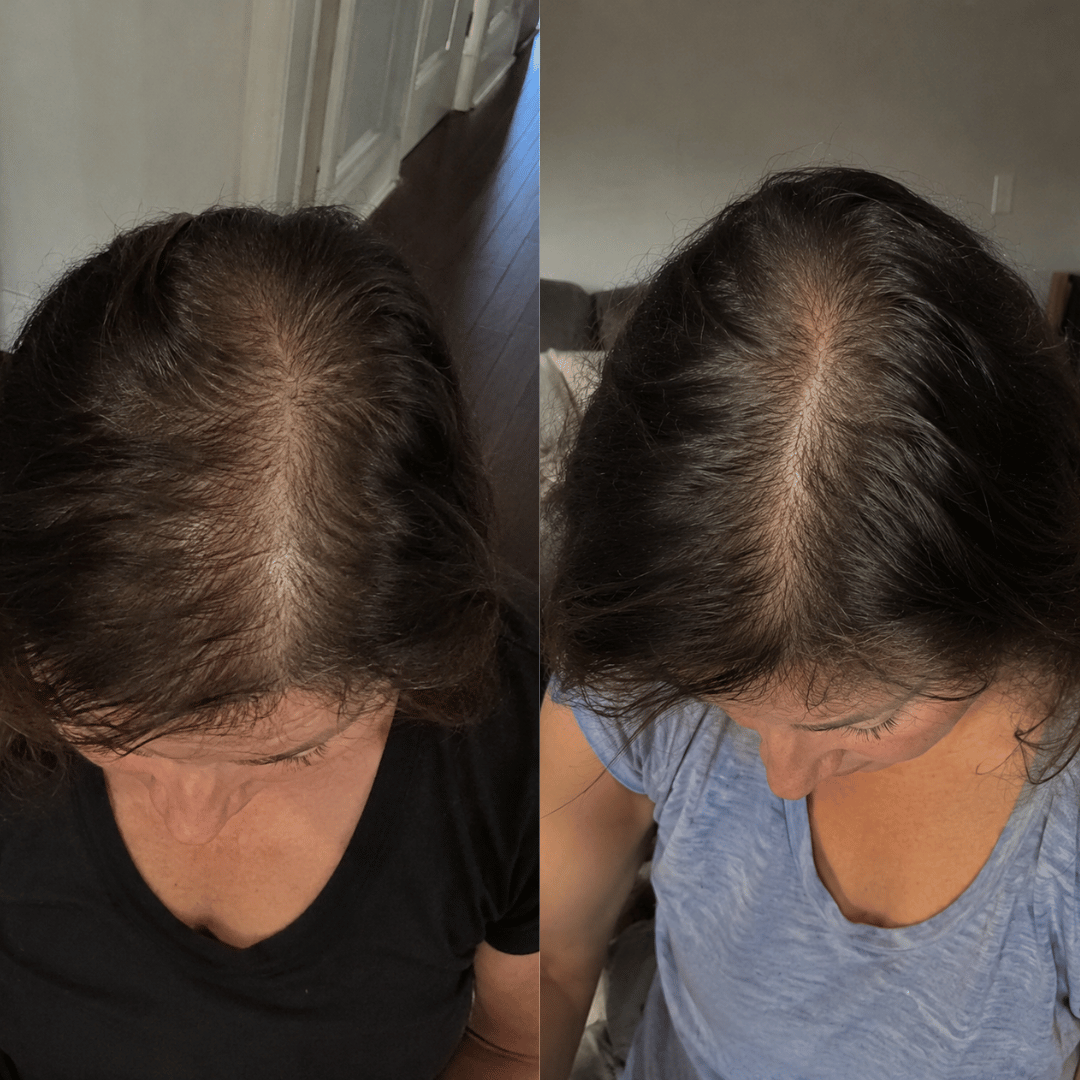 A before and after comparison showing the top of a woman's head with thicker hair in the second image.