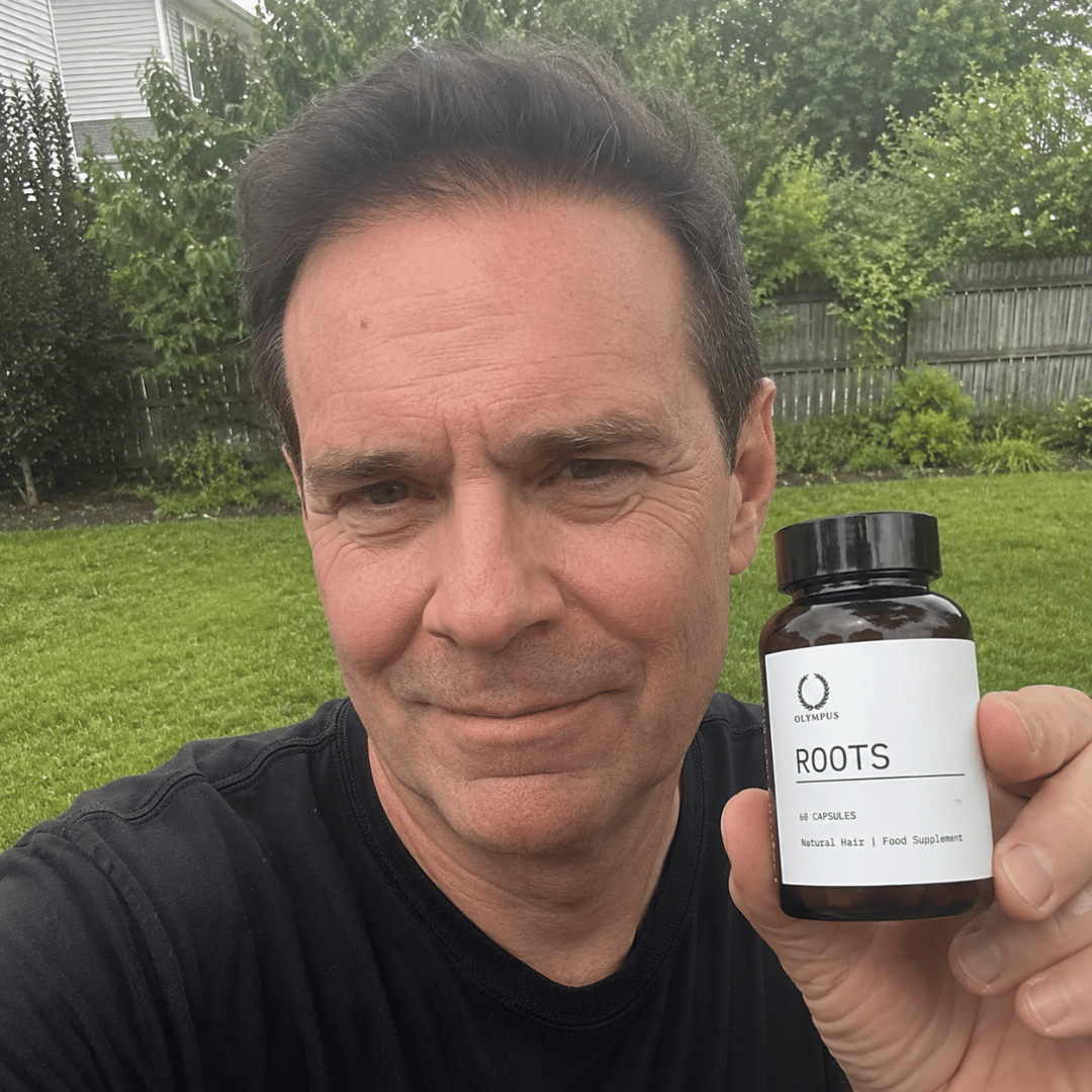 A man in a black t-shirt holds a bottle of Olympus Roots hair supplement in a backyard.