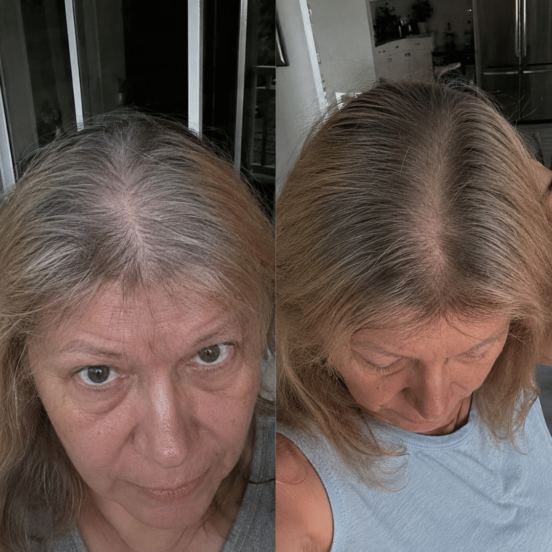 A side-by-side comparison of a woman's scalp, showing a difference in hair color and fullness at the part.