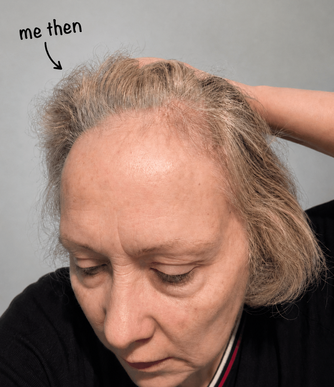 A woman looks down, her hand in her hair, revealing thinning gray hair, with text reading 'me then'.