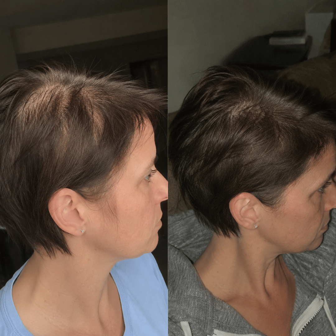 A before-and-after comparison of a woman's hair, showing it is visibly thinner on the left and thicker on the right.