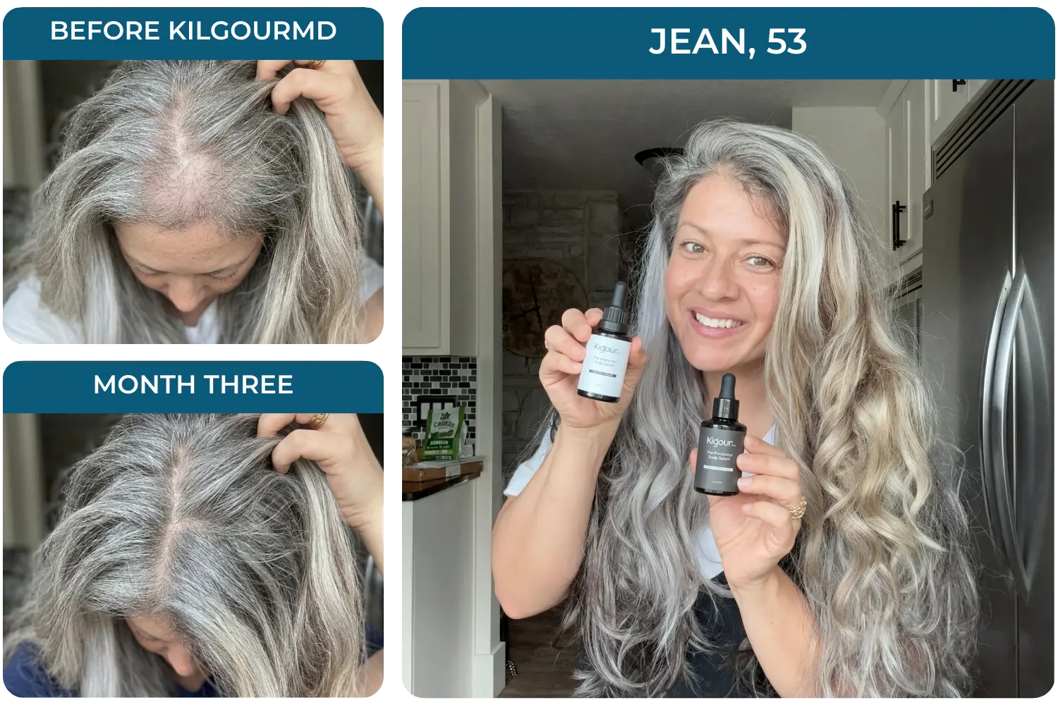 A three-panel image showing before and after photos of a woman's hair growth, and her holding the products.
