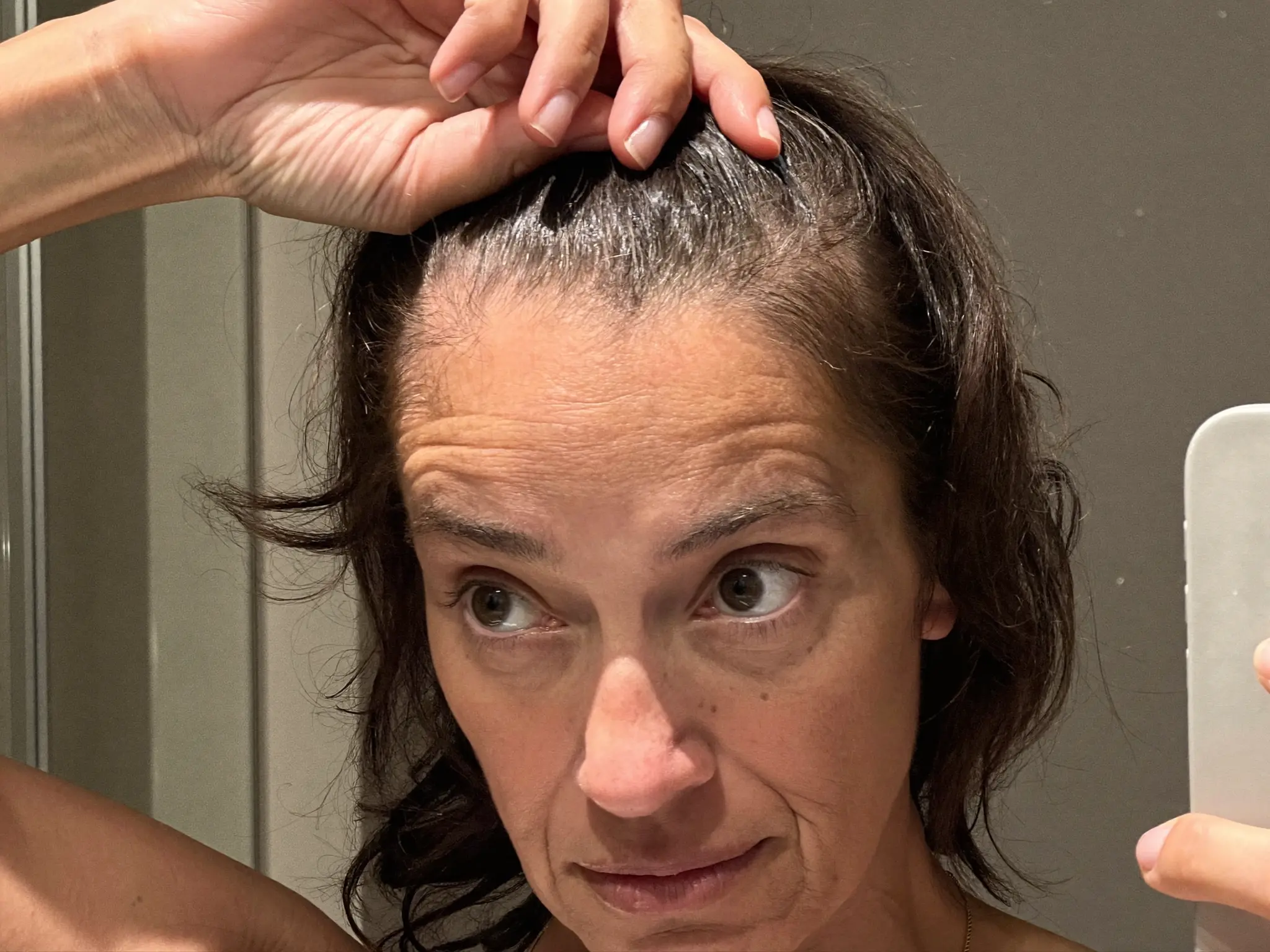 Donna R, 58 &mdash; before and after