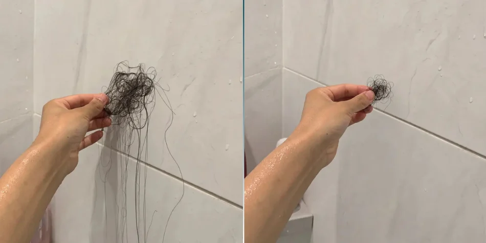 Loose roots rebuilt by Capixyl
