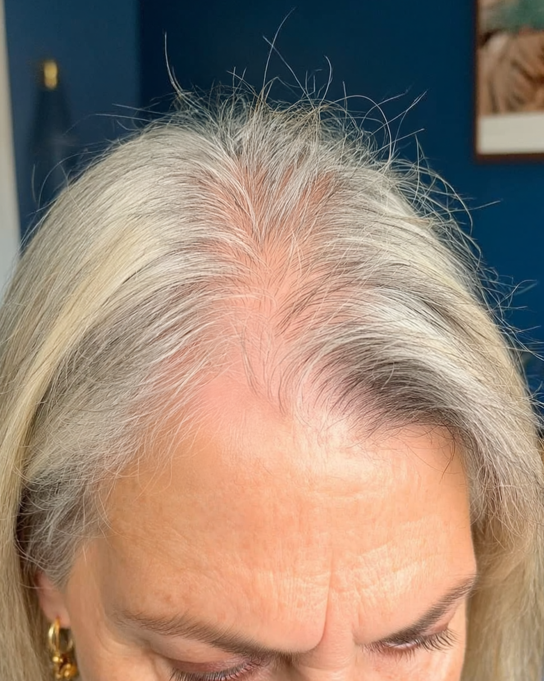 Close-up of a person's scalp with thinning gray hair.