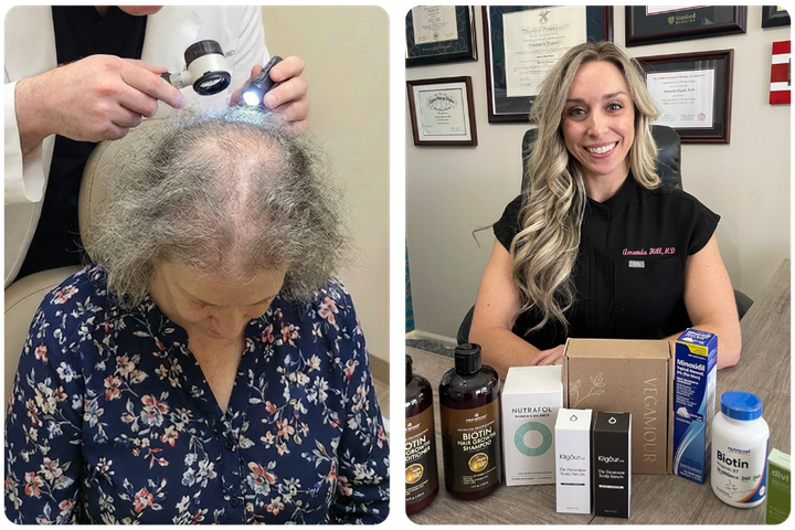 A split image showing a doctor examining a woman's thinning hair and a professional with hair growth products.