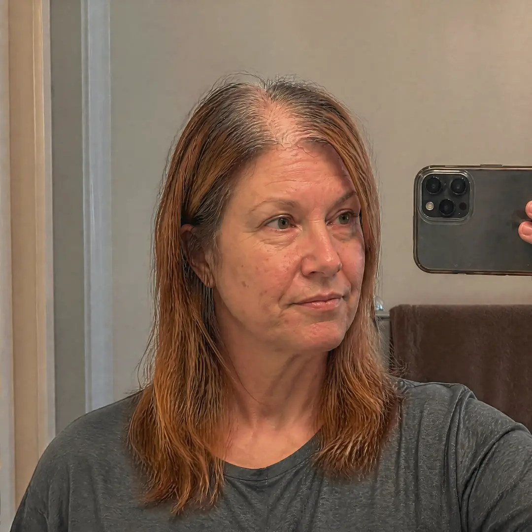 Deborah H. before