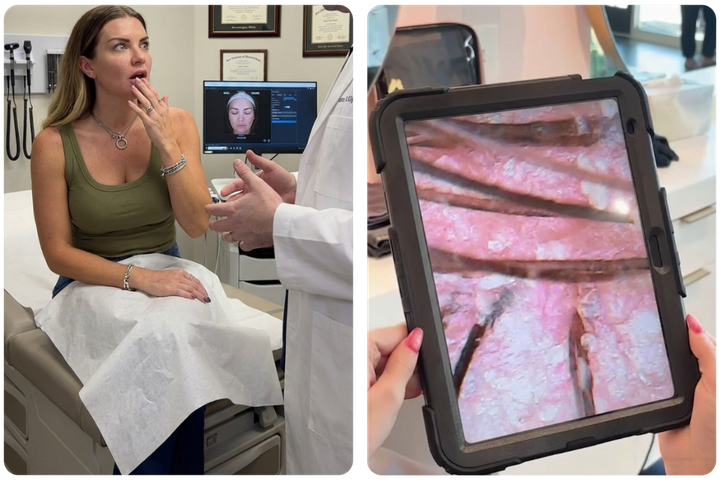 A split image showing a woman in a doctor's office and a magnified view of a scalp.