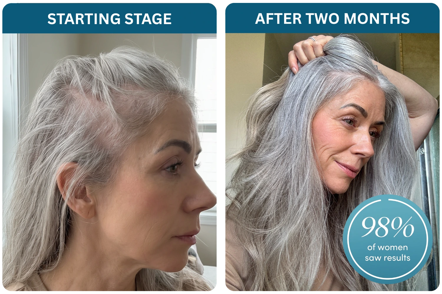 A before and after image showing a woman's hair looking fuller and thicker after a two-month period.