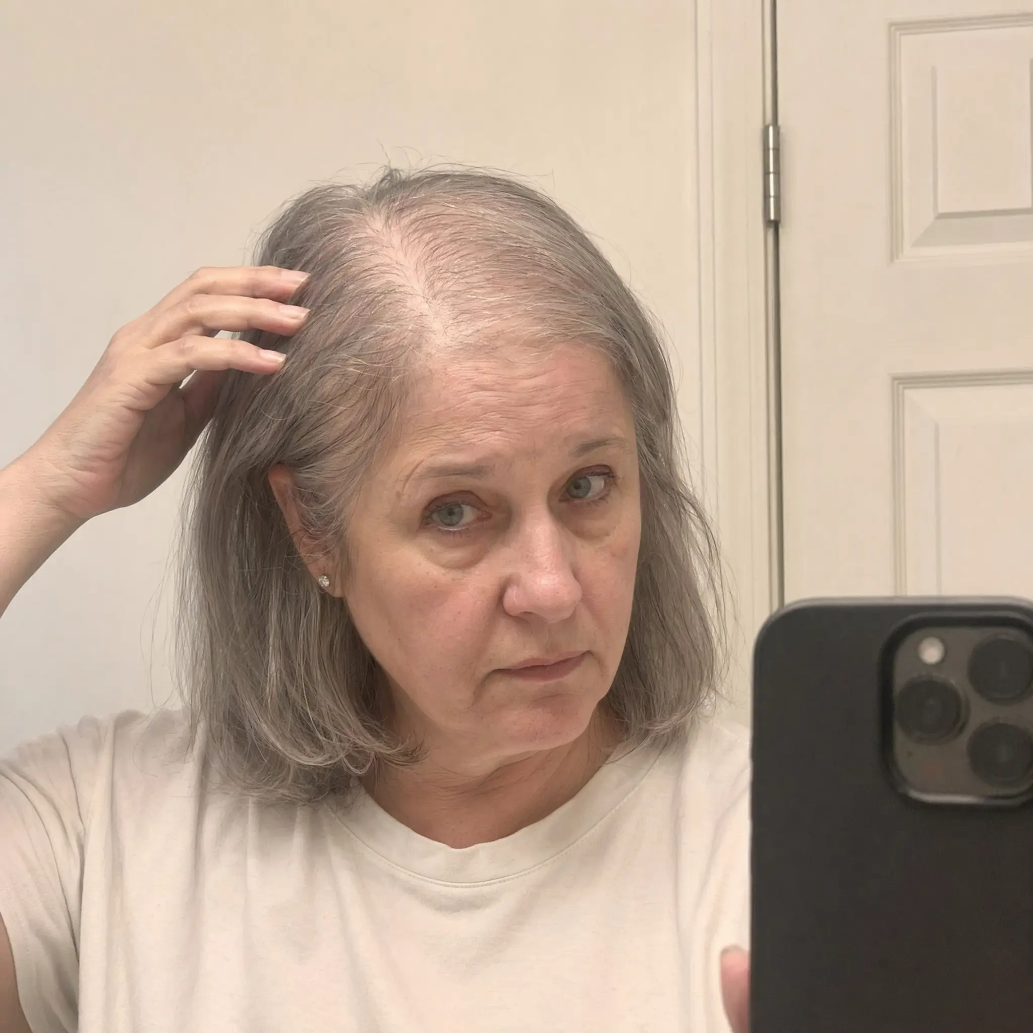 Patricia W. before