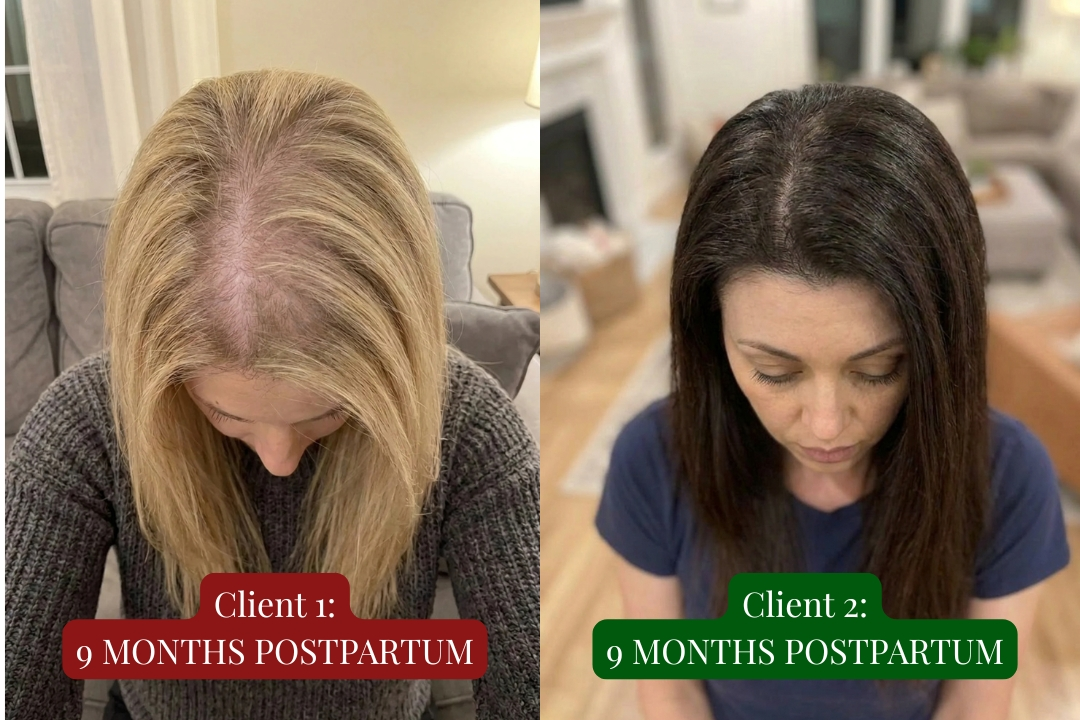 Two women at 9 months postpartum, side by side